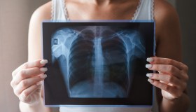 Tumore polmonare, perché chi fuma è a rischio e come scoprirlo presto