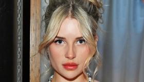 Lottie Moss, brutto risveglio per la sorella di Kate: cos’è successo al suo viso