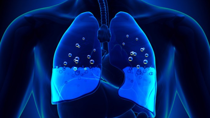 Edema polmonare: cos’è, come si manifesta e quanto è pericoloso