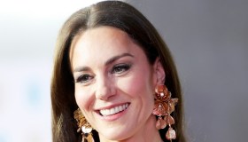 Kate Middleton, il botox vegetale anti-rughe con Alcmella Oleracea a 10 euro