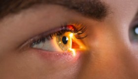 Cos’è, come si fa e quando è indicato l’OCT