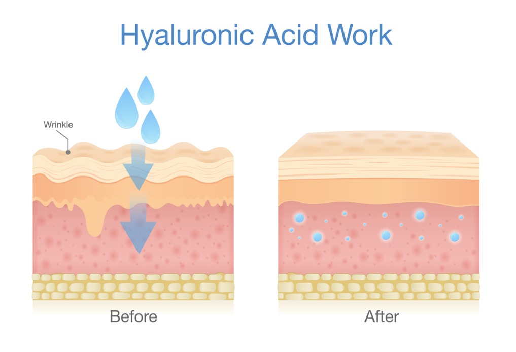 Come lavora l'acido ialuronico sulla nostra pelle