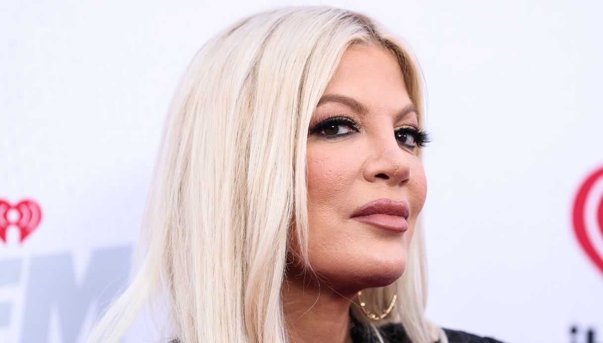 Preoccupazione per Tori Spelling: il ricovero in ospedale e i lividi sul volto