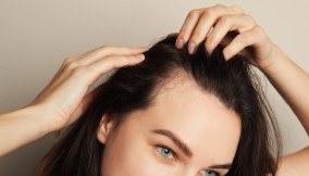 alopecia areata cure