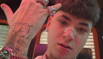 Giulia De Lellis sdogana il botox: “Sì l’ho fatto. Ma c’è chi mente”