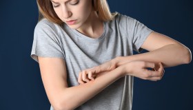 Psoriasi, come si vive con la malattia: lo studio