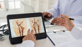 Emorragia cerebrale: cos’è, sintomi e cause