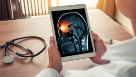 Meningite da meningococco: cos’è, sintomi e come trattarla