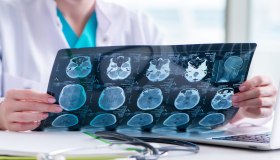 Epilessia, quando ha senso l’impianto di elettrodi nei bambini