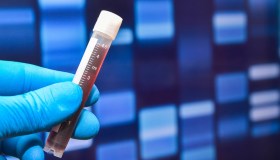 Amilasemia, che cos’è e quando occorre eseguire il test