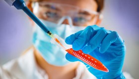 Test genetici per il tumore al seno, quando servono e a chi