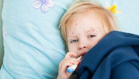 Varicella, come si presentano le lesioni cutanee e le complicanze più comuni