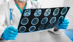 Sla, le nuove linee guida per la Sclerosi Laterale Amiotrofica