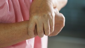 Algodistrofia: cause, sintomi, cura