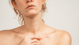 Cicatrici: come si formano e come trattarle