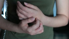 Dermatite allergica: cause, sintomi e cura