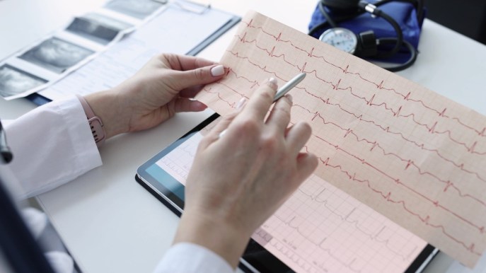 Elettrocardiogramma (ECG): cos’è e come si svolge