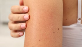 Lesioni cutanee: classificazione e diagnosi