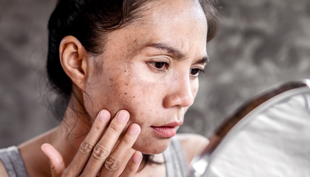 Macchie della pelle: tipologie e cause