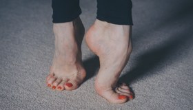 Piede cavo: tipologie, cause, sintomi, cura