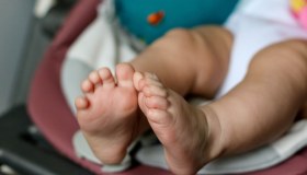 Piede torto congenito: cos’è, cause, cure