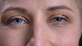 Ptosi palpebrale: cause, sintomi e terapie