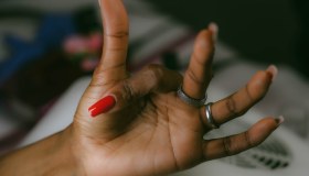 Sindrome di Dupuytren: cos’è, sintomi, terapia