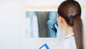 Tumori ossei: tipologie, cause, diagnosi, cure