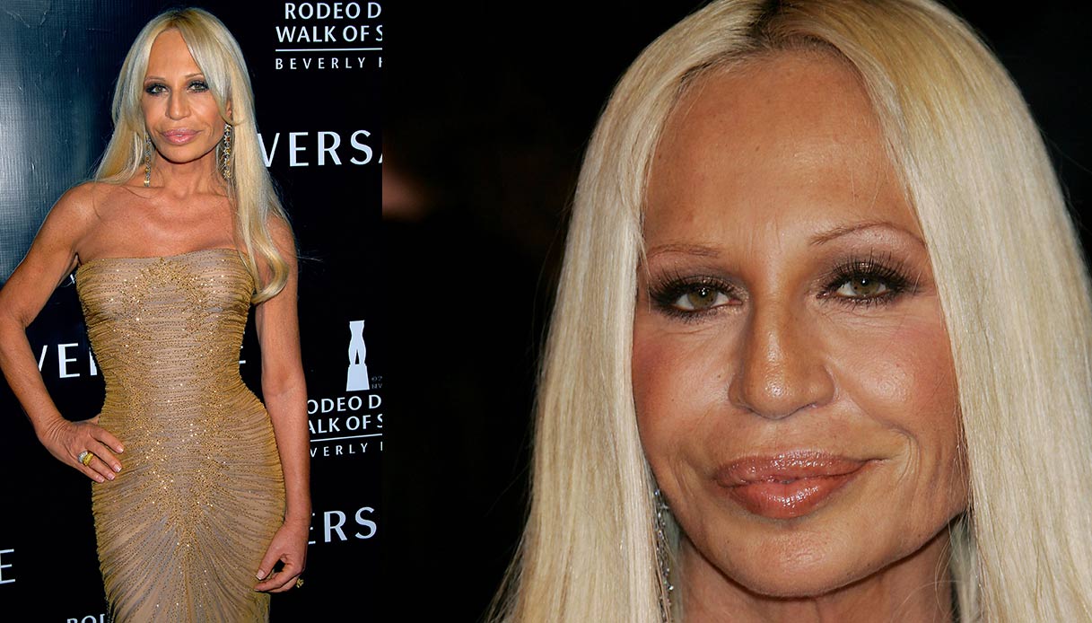 donatella versace prima e dopo
