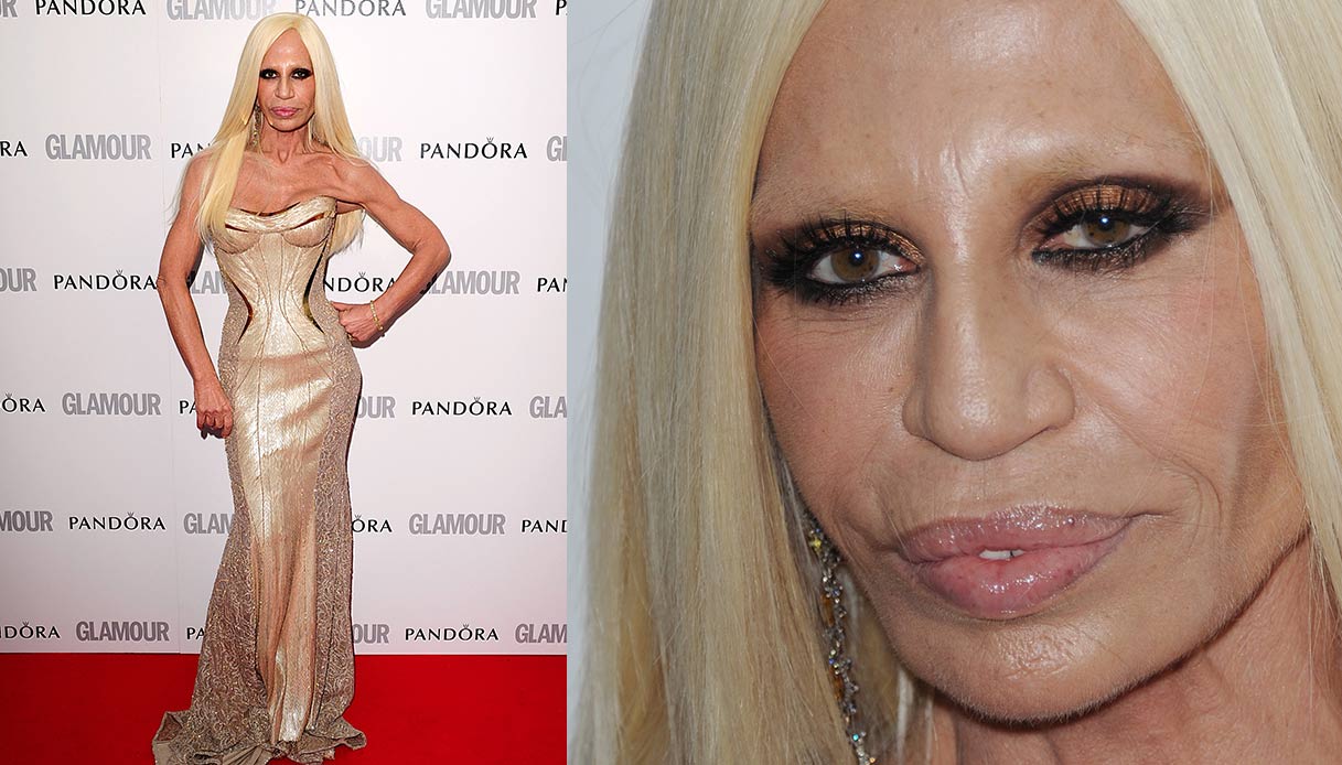 donatella versace prima e dopo