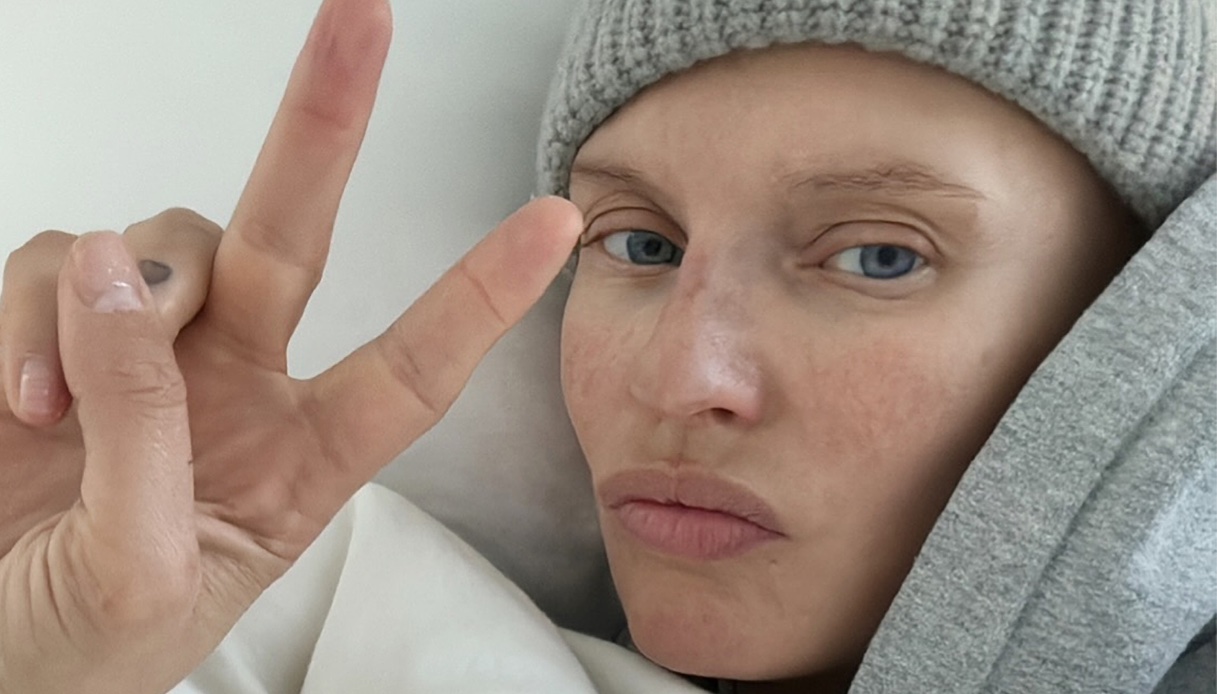 Bianca Balti con “una lunga cicatrice e senza capelli” sfida il cancro: “Non mi fermo”