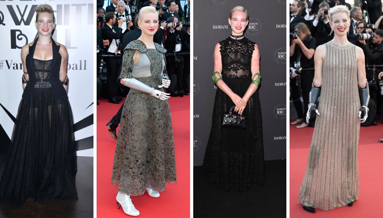 Bebe Vio, 10 look che hanno fatto la storia tra total black e tessuti preziosi