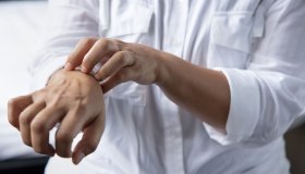 Dermatite atopica, come si manifesta e le cure su misura