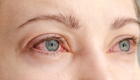 Primavera e benessere oculare, come affrontare le allergie e l’occhio secco