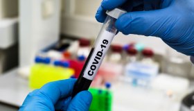 Covid, cosa sappiamo della variante LP.8.1, come si manifesta e cosa fare