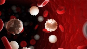 Immunoterapia e anticorpi bispecifici per i tumori del sangue, quando servono e come funzionano