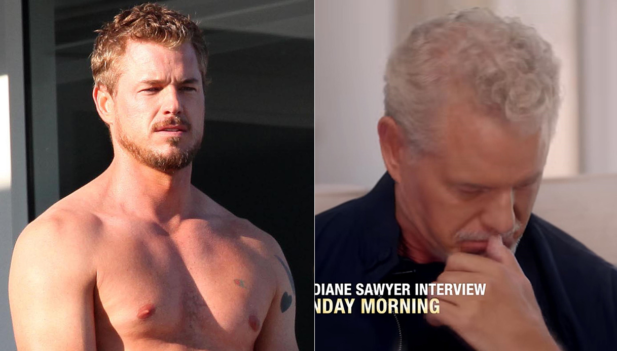 Eric Dane di Grey’s Anatomy: la battaglia contro la SLA