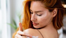 Pelle con rosacea: i migliori solari per proteggersi e stare al sole in sicurezza