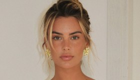 Sophie Codegoni fa un passo indietro e rimuove il filler: “Scelta migliore”