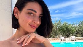 Yoga Radio Estate 2025, le pagelle del 19 agosto: Orietta Berti favolosa, ma Rebecca Staffelli è la vera regina (10)