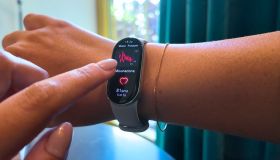 Xiaomi Smart Band 10: stile e salute a meno di 50 euro
