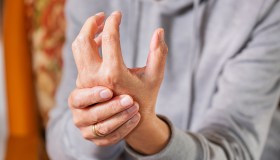 Artrite reumatoide, Lupus e non solo: perché il fumo fa male alla donna con malattie reumatologiche