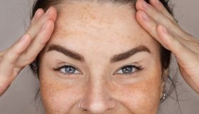 Macchie solari sul viso: tutti i rimedi per intervenire adesso