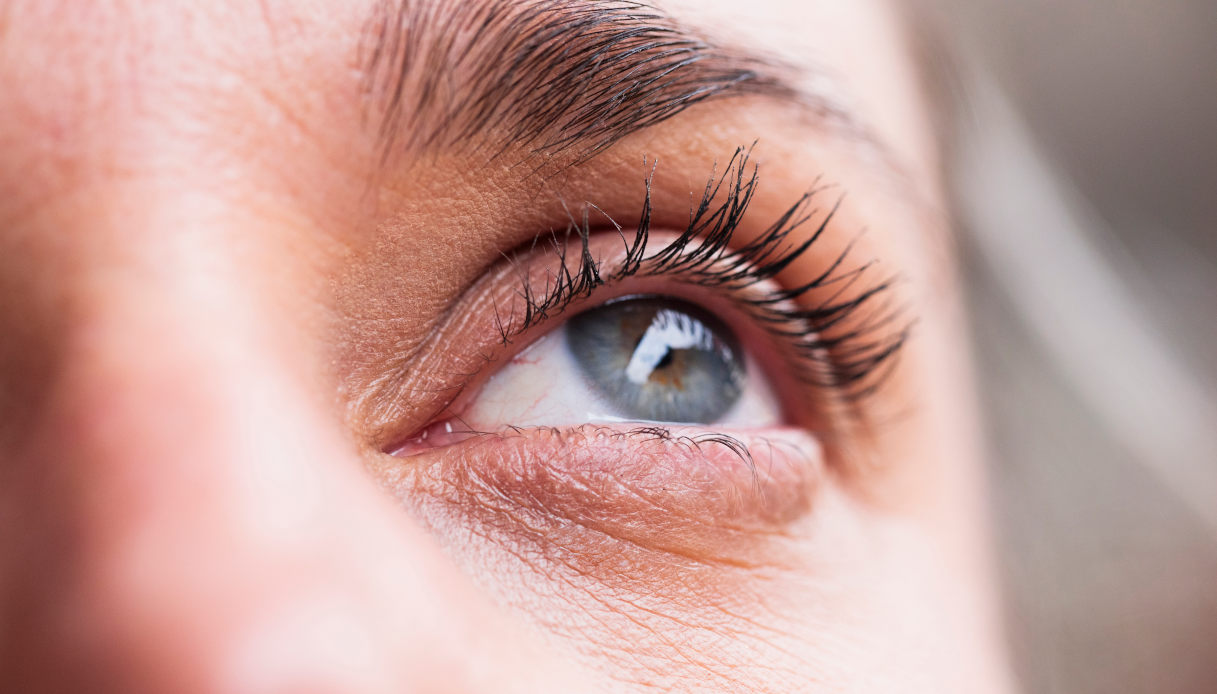 Ti presento TED: la Malattia Oculare Tiroidea si racconta in prima persona Ti presento TED: la Malattia Oculare Tiroidea si racconta in prima persona