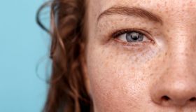 Lenisce, idrata, protegge e ripara. Il balsamo viso corpo consigliato dai dermatologi è l’indispensabile della stagione