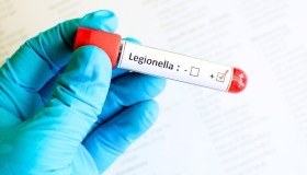 Legionella, nuovo allarme: a Milano 11 casi e una vittima. La diffusione e le precauzioni