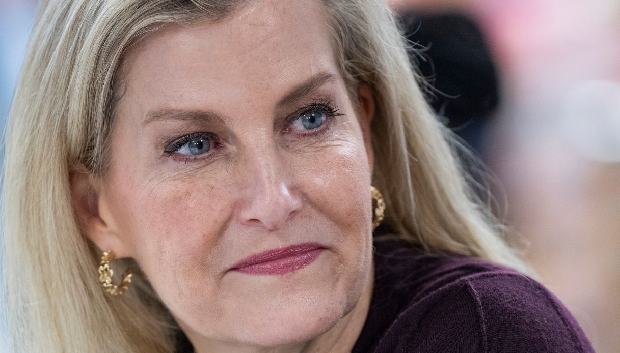 La pelle di Sophie di Edimburgo