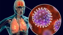 Virus Nipah, cosa sappiamo dell’infezione, come si trasmette, cosa provoca