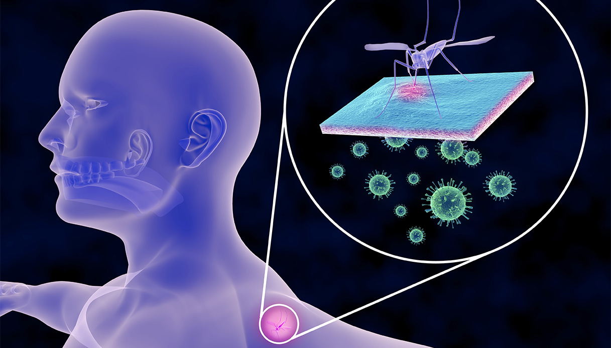 Chikungunya, c’è il vaccino: a chi serve, come funziona, prima di quali viaggi è indicato
