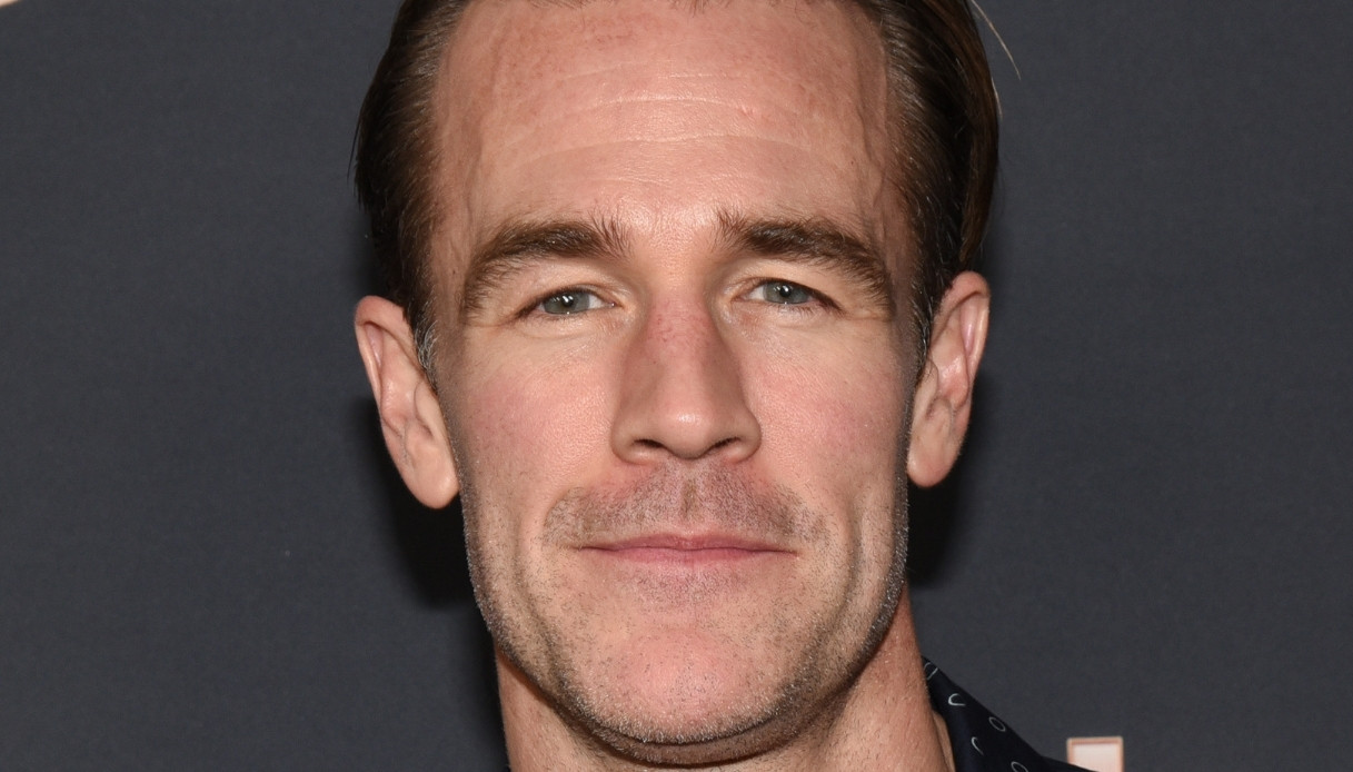 Morto James Van Der Beek, addio a Dawson Leery: aveva solo 48 anni